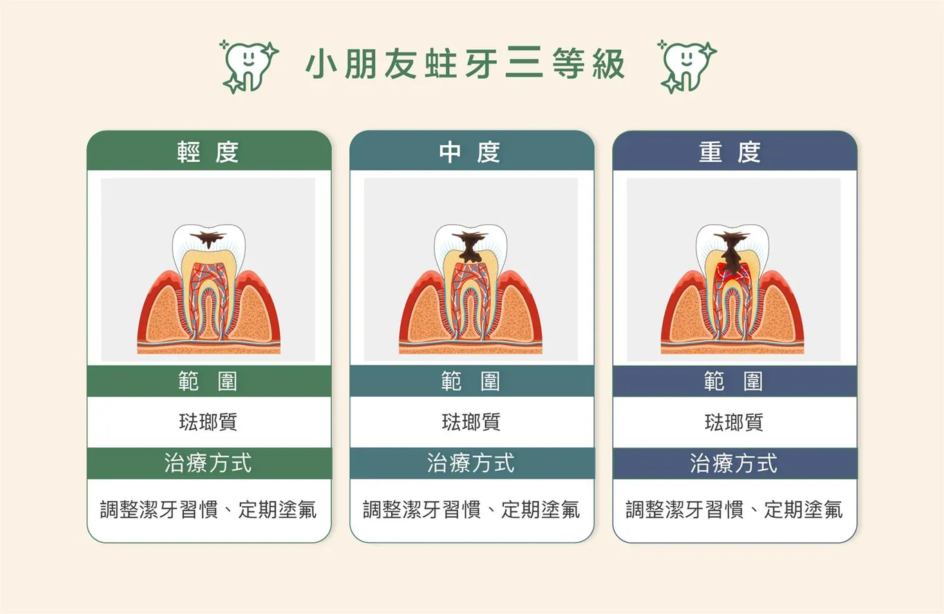 ▍兒童容易蛀牙的原因