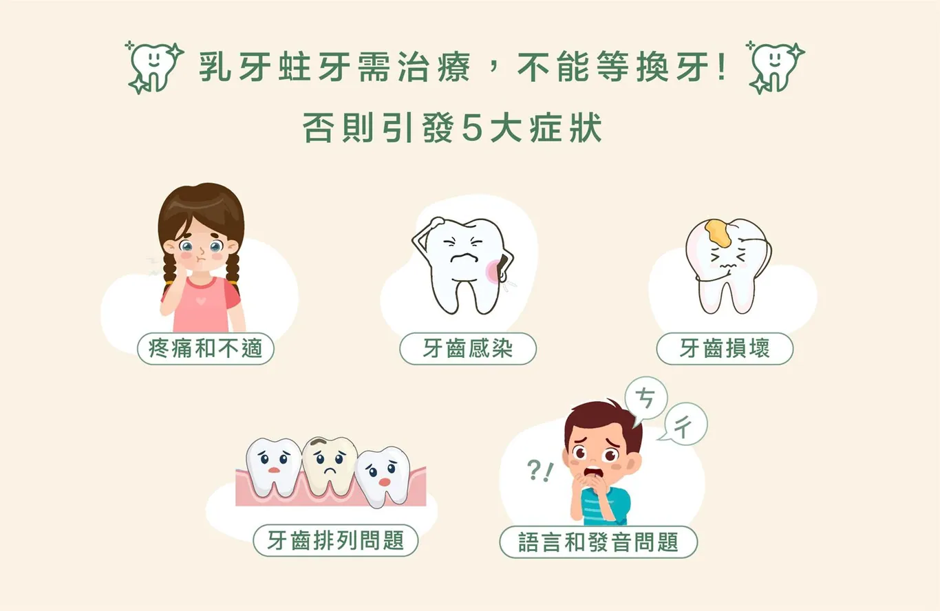 ▍乳牙蛀牙需治療嗎？