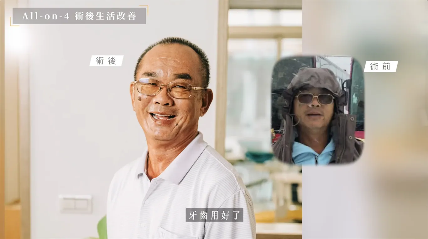 台南全口重建專家盧佳豪醫師