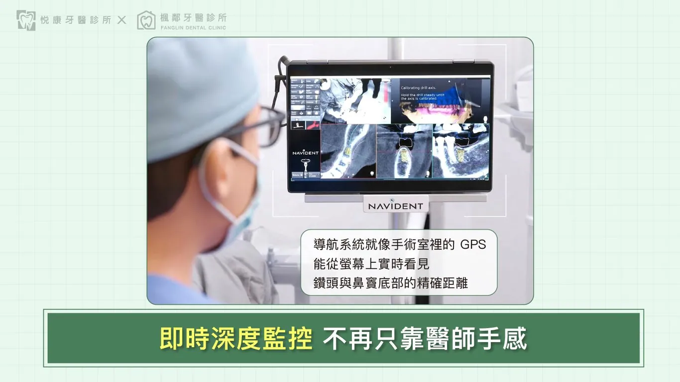 台南全口重建推薦盧佳豪醫師