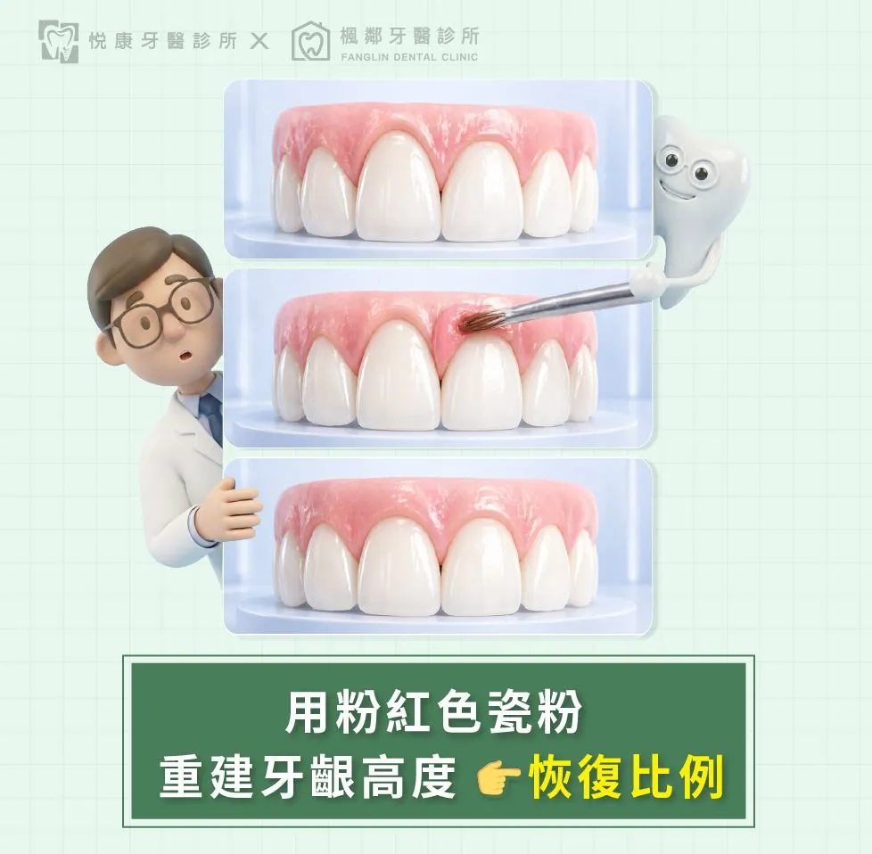 台南全口重建推薦盧佳豪醫師