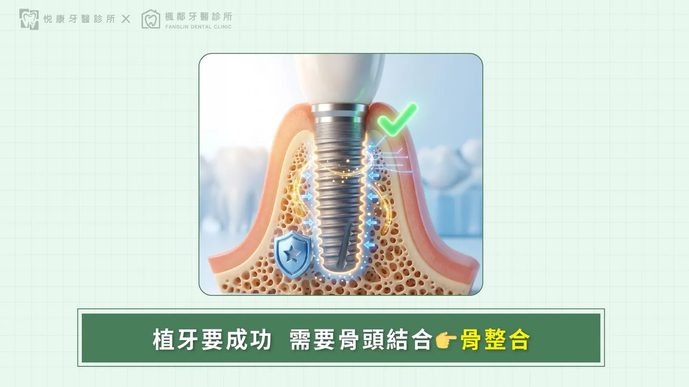 台南全口重建推薦盧佳豪醫師