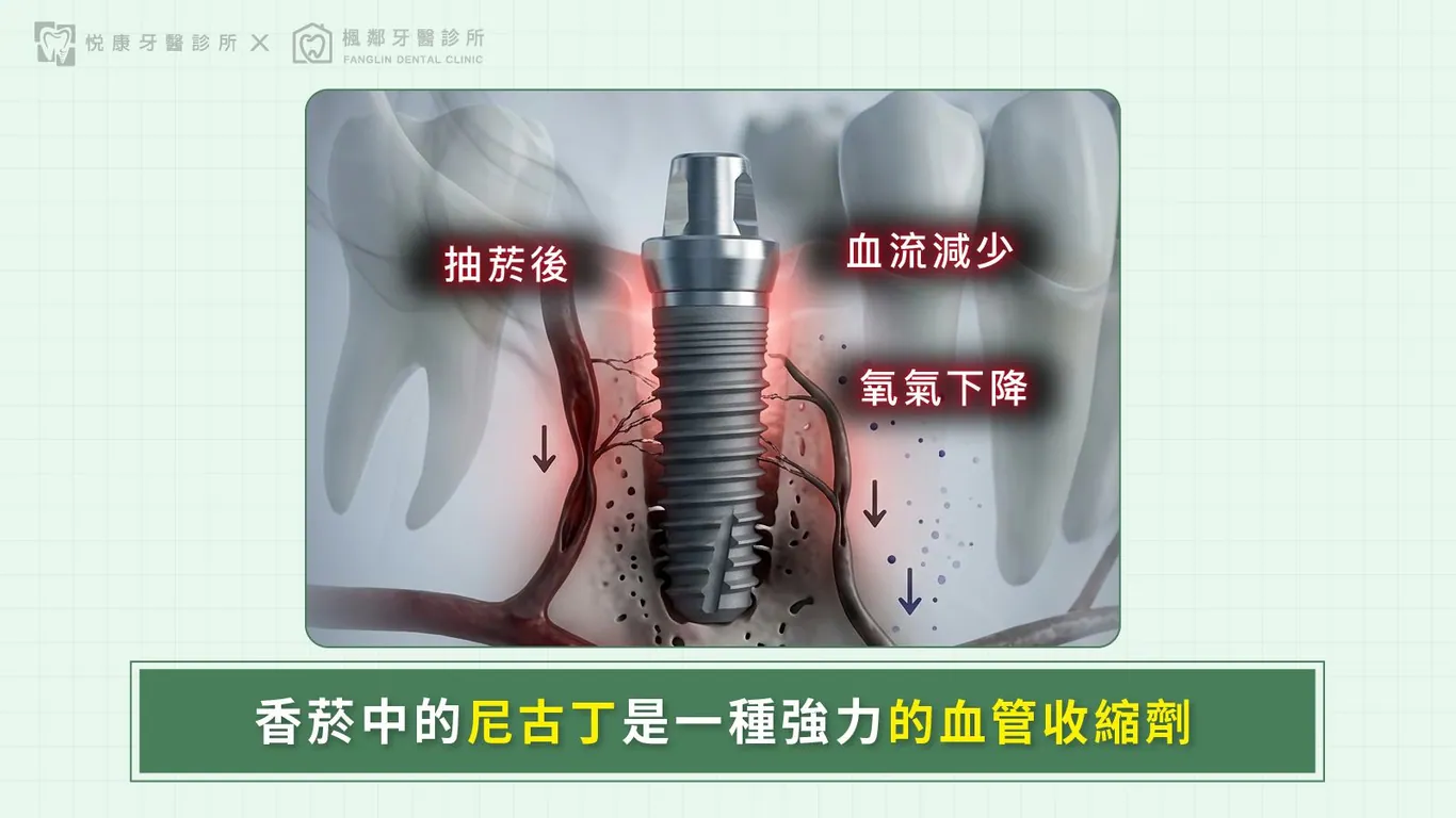 台南全口重建推薦盧佳豪醫師