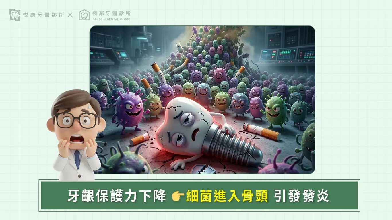 台南全口重建推薦盧佳豪醫師