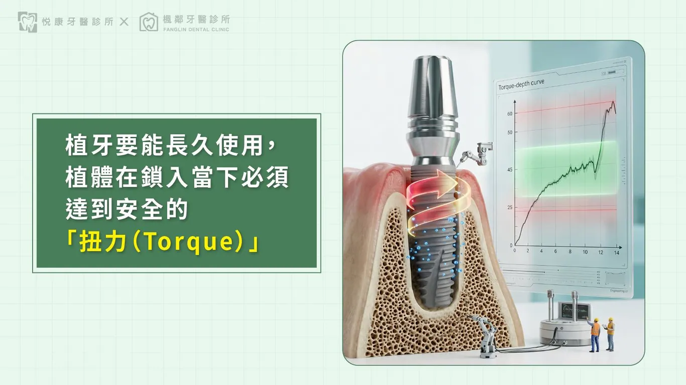 台南全口重建推薦盧佳豪醫師