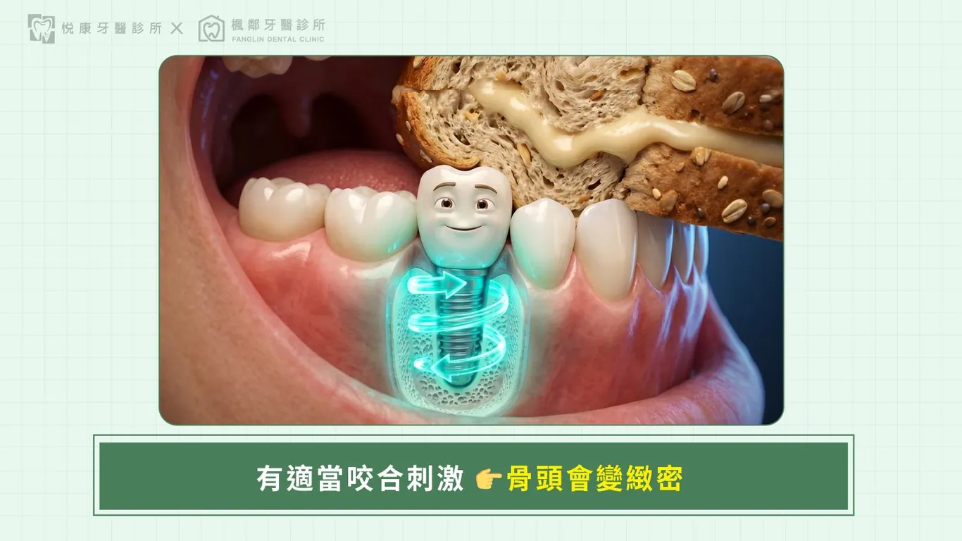 台南全口重建推薦盧佳豪醫師