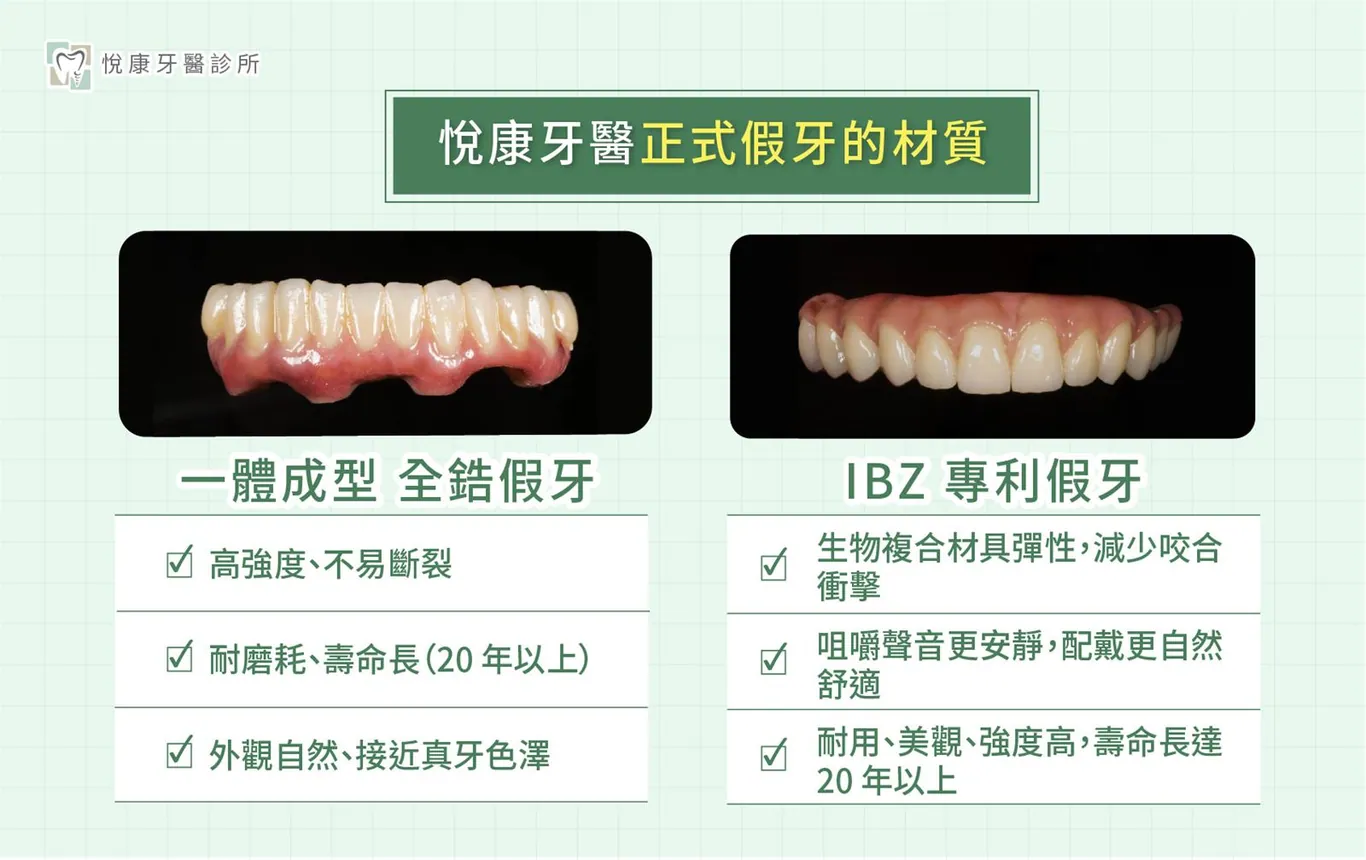 ▍5. 悅康牙醫正式假牙的材質？