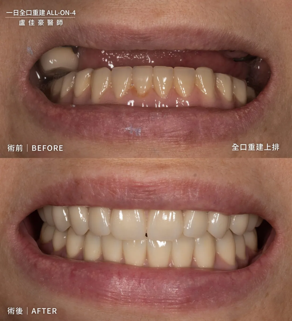 案例 30