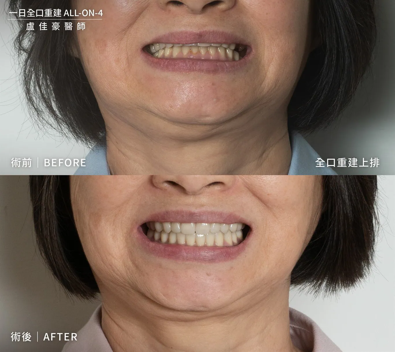 案例 30