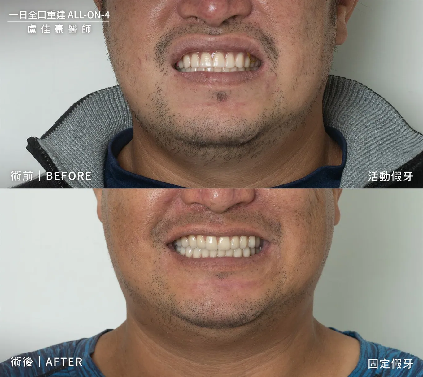 案例 36