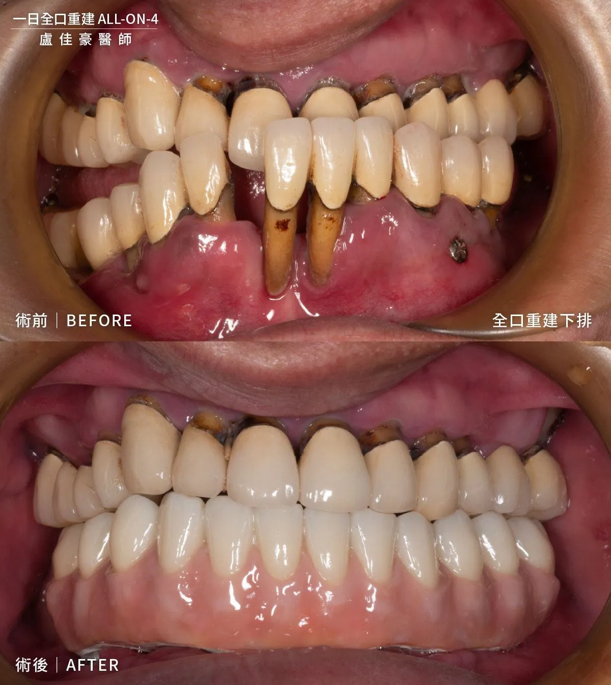 案例 29