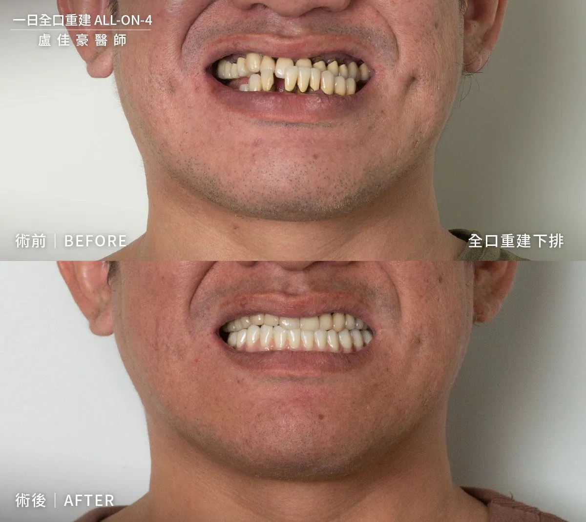 案例 29