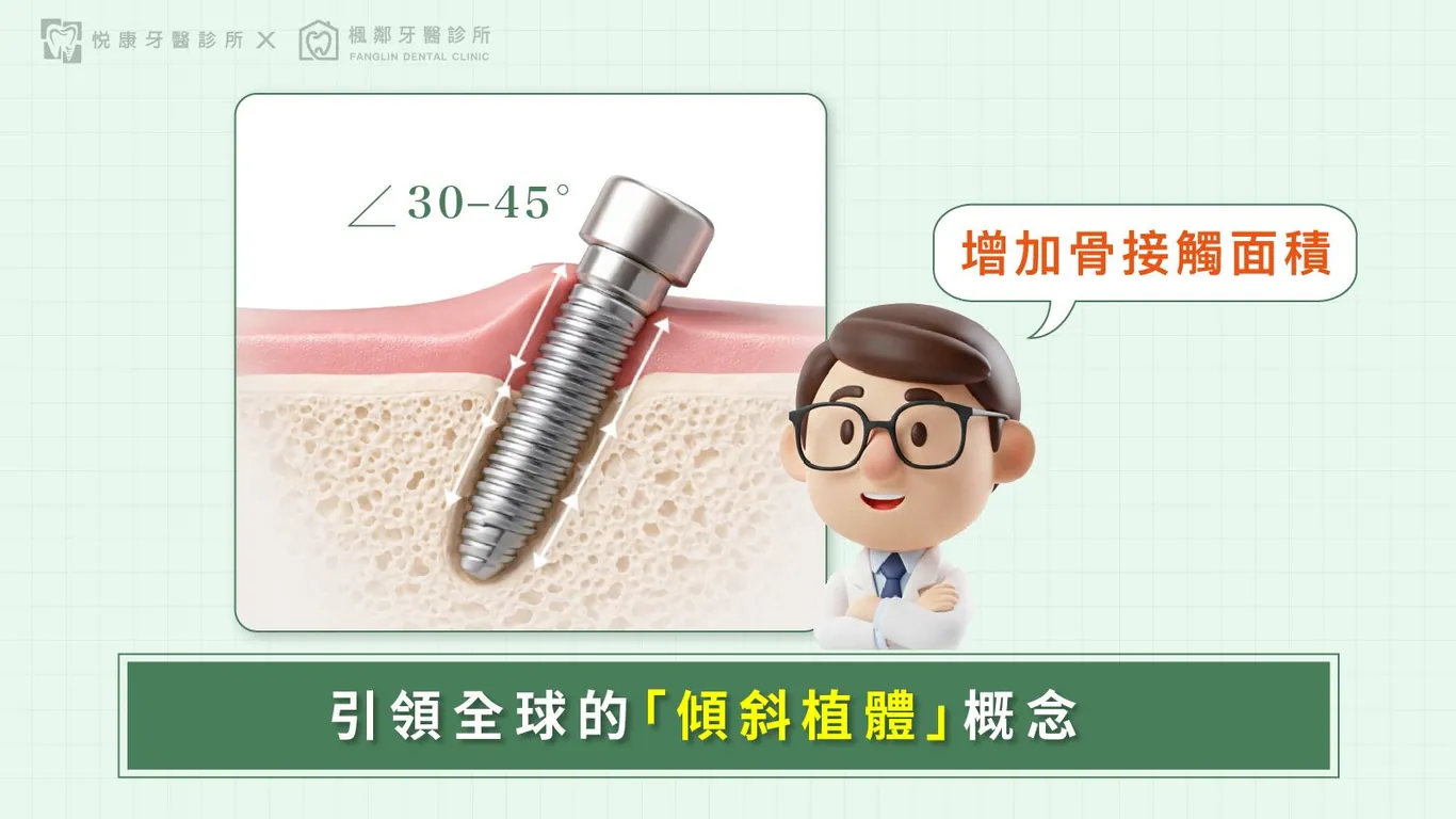 台南全口重建推薦盧佳豪醫師